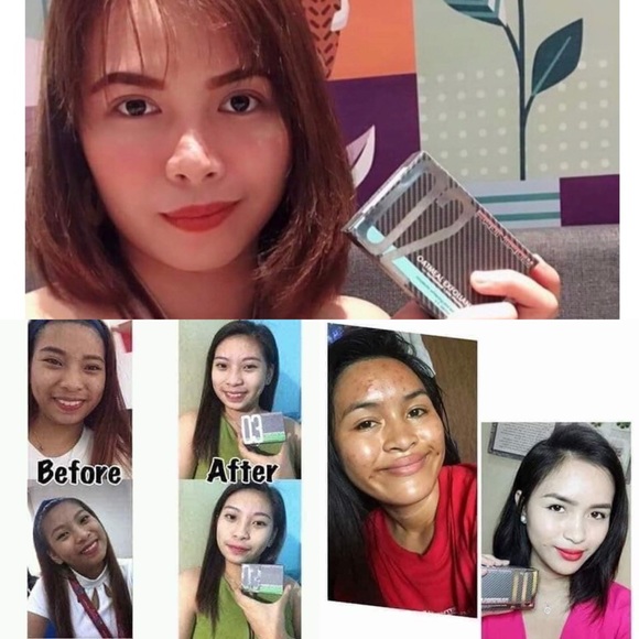 Frontrow Luxxe - Picture 10 of 10